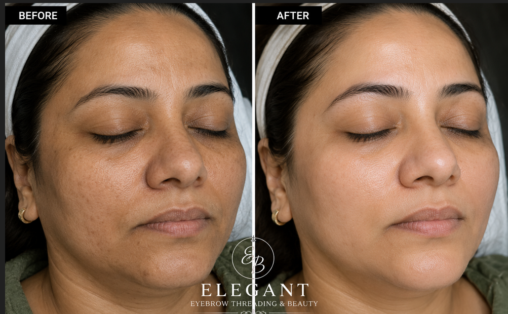 Real client facial result