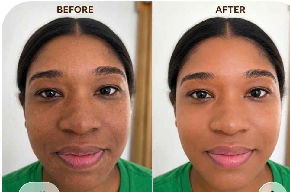 Real client restorative facial result