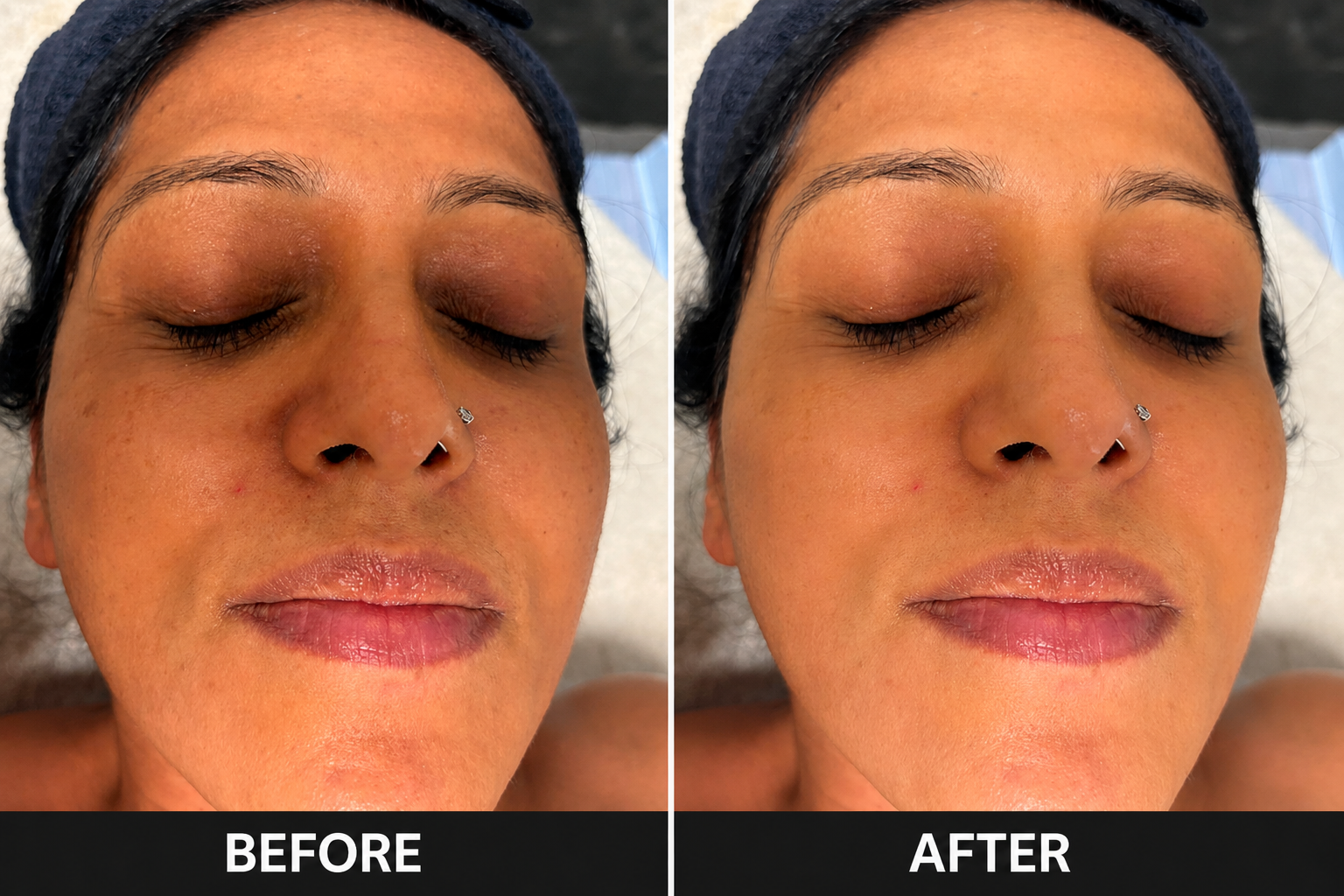 Real client restorative facial result