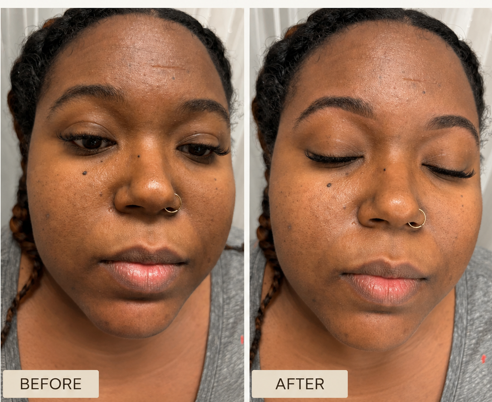 Real client before and after brow result in Lutz