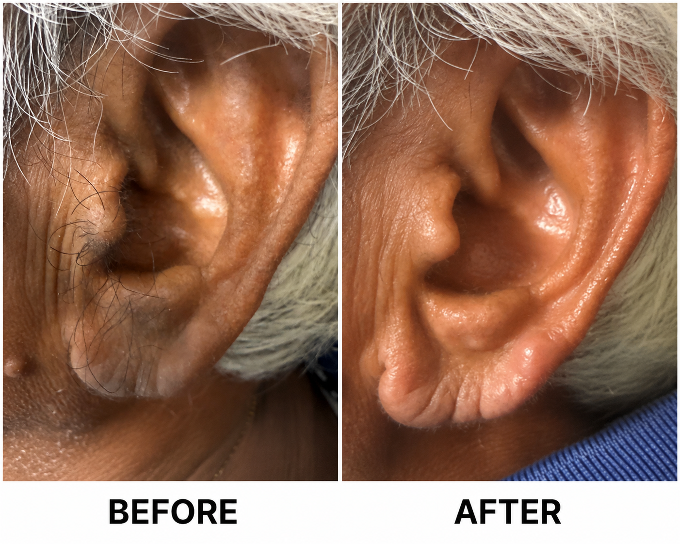 Real client nose waxing result